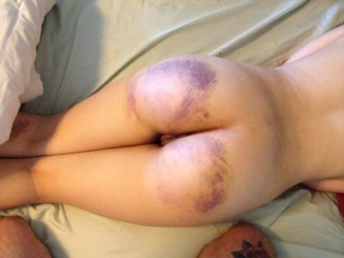 hishappylittlepet:  his-kiitten:  I miss having a bruised bottom :(  I have one
