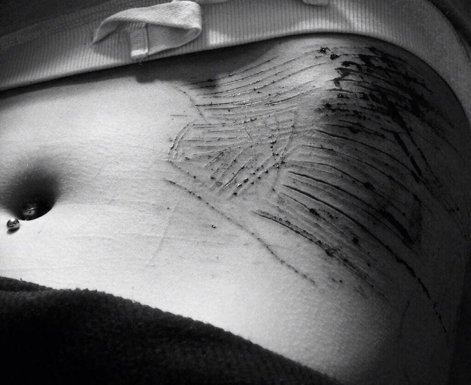 princesswithsuicidalmind:  Pequeñas navajas que se vuelven tus amigas… :)