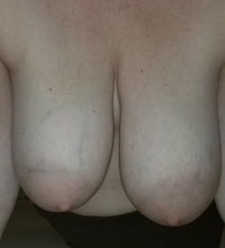 veinybreastsandmore:  My wifes veins  Wow