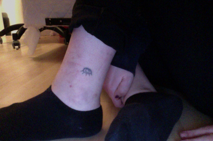 Fuck Yeah, Stick n' Poke! — An eye on my ankle for my Series of  Unfortunate...