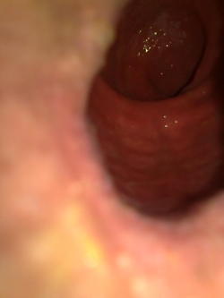 biggerdeeper:  Look into my hole 