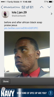 proteinpills:cocoacolabear:fvckrealityx:mysticalafrofairy:rudegyalchina:Yall be sleeping  #africanblacksoap  African Black Soap is God  where can i get some ?  The best part is when white folks ask what you use and then watching them stumble over asking