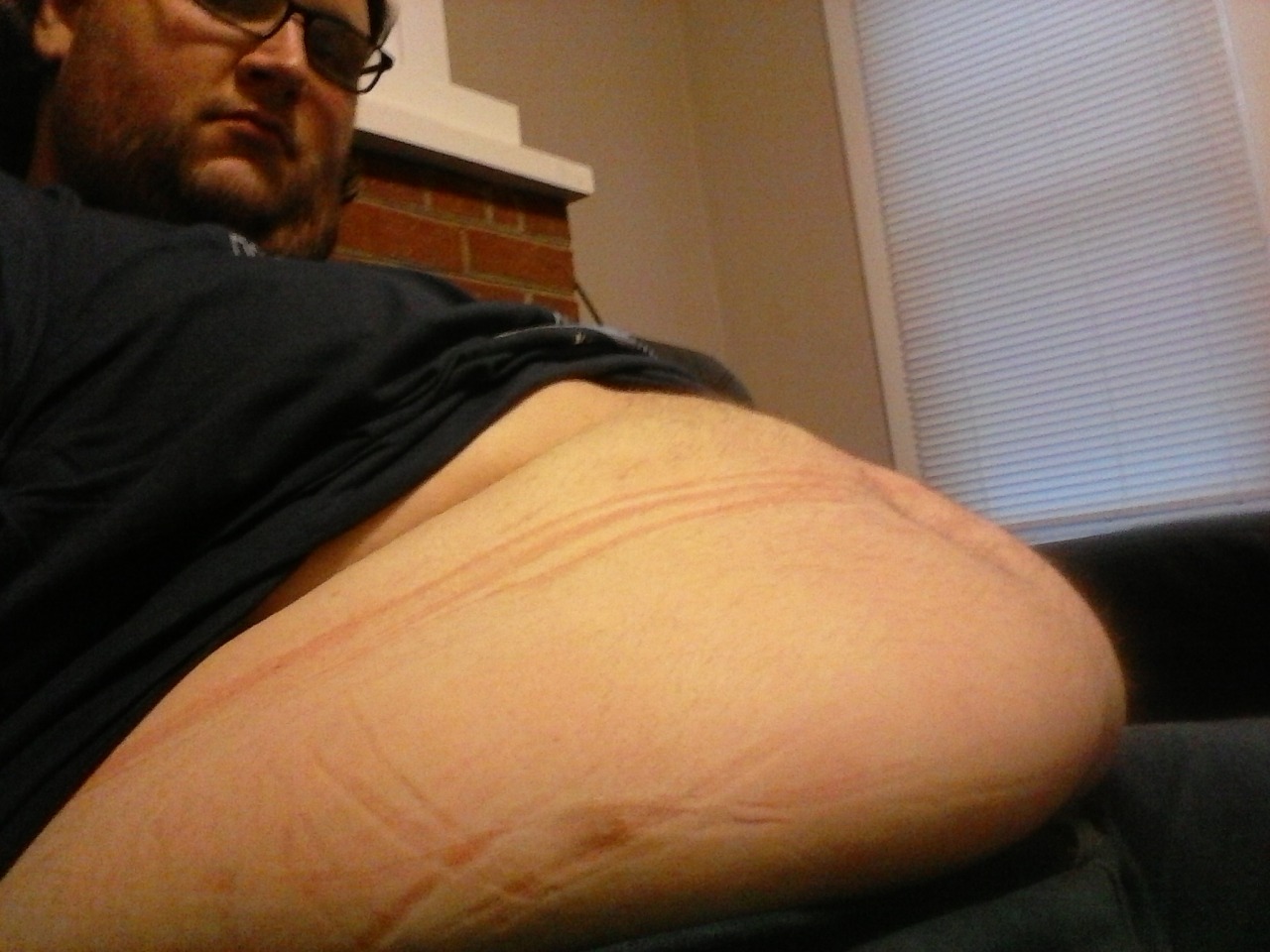 Belly pics per anon request. Enjoy :)