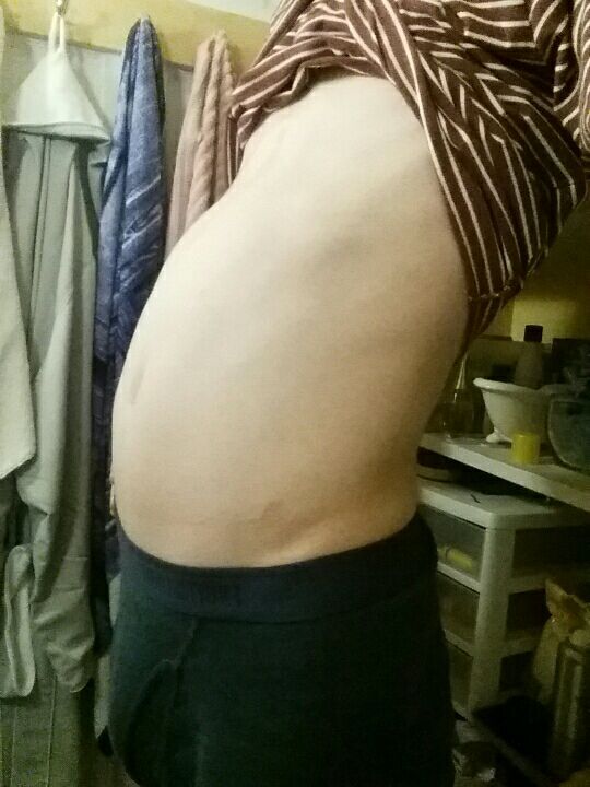 skinnybellyblimp:  Ffffffffff I need to stop eating so much, my stomach was stretched