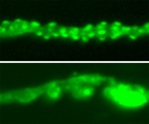 Flies offer insights into motor neuron diseaseALS is one of the most common forms of motor neuron di