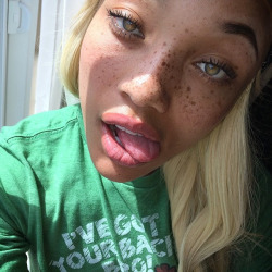 famousbutunknown:  cocaine_lorraine