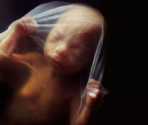 scienceyoucanlove:  From: “A Child Is Born” by Lennart Nillson 