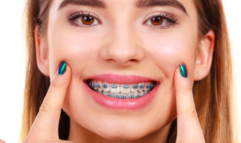 Auburn Lakes Orthodontics — Why Do Teeth Look Bigger After Braces?