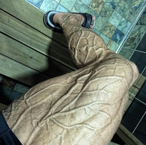 Zane Watson - HOLY DICK SKIN WTF IS THAT MUTANT LEG FROM ANOTHER PLANET! Looks Like The Gnarled branches