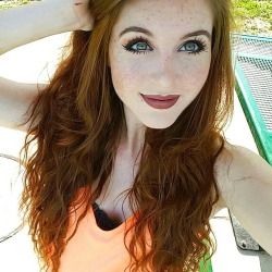 yesgingerfriend:  hellyeahredheads:Danielle Boker Schöne Sommersprossen