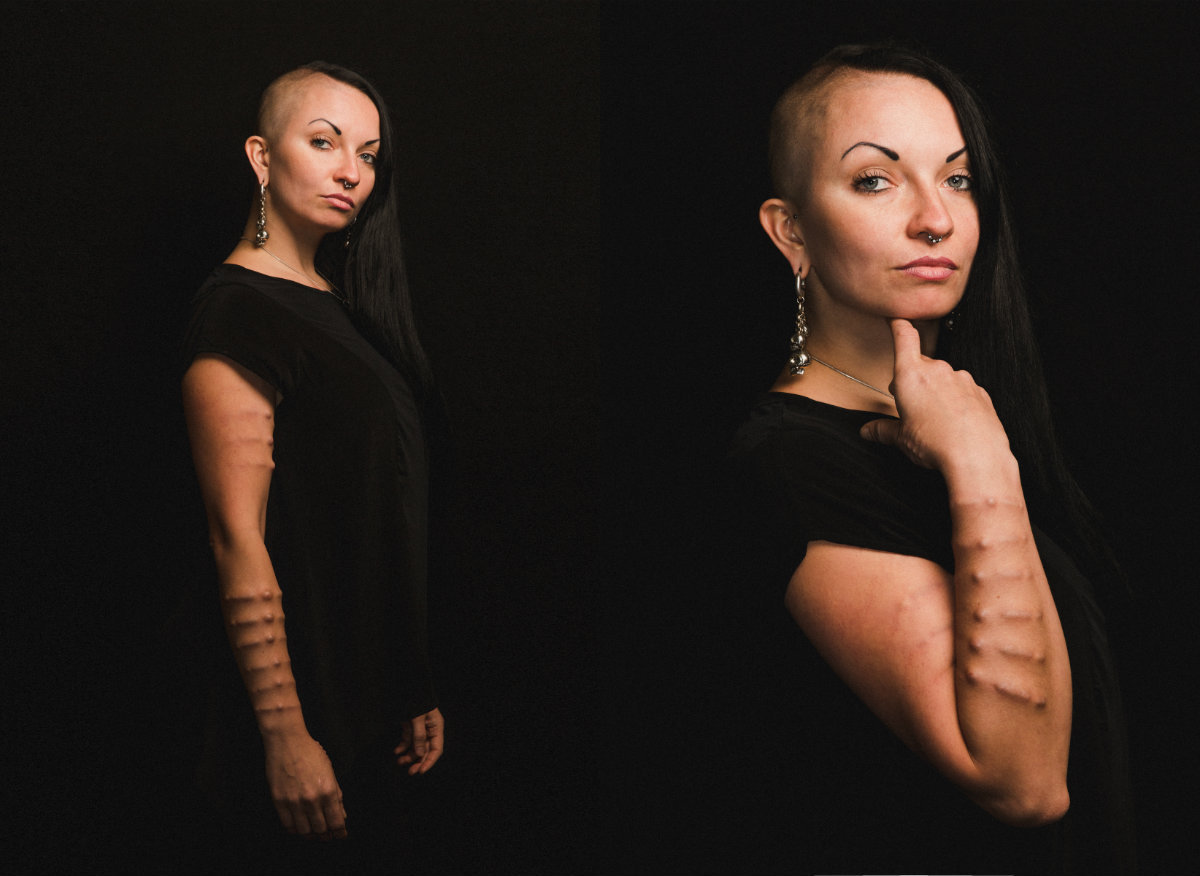 huffingtonpost:16 Women Show The Beauty In Body ModificationBody modification includes