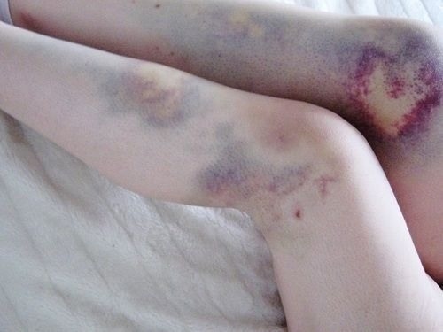 Artpale:  “It’s sassy and pale bitch.”