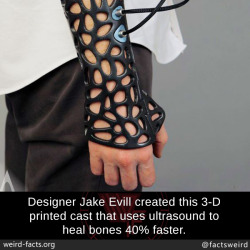 mindblowingfactz:  Designer Jake Evill created this 3-D printed cast that uses ultrasound to heal bones 40% faster.