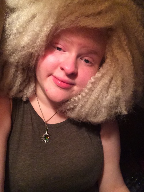 invisiblemelanin:Black people with albinism are strong and beautiful, don’t deny our heritage.