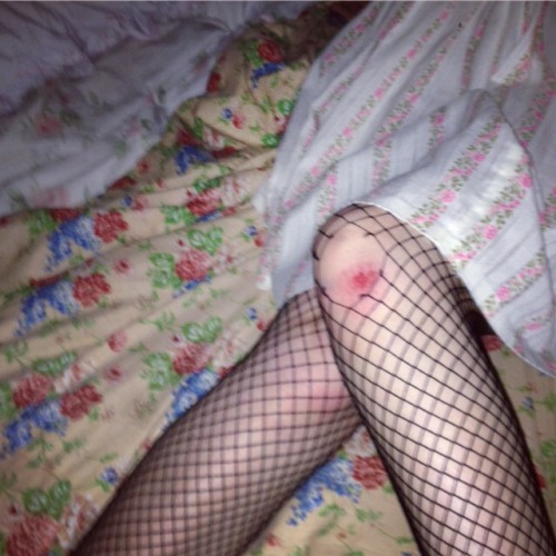 y-e-t-a-x-a: when you graze your knee and rip your tights but it’s aesthetic so it’s oka