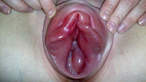extremeperverseporn: Pussy Pump Attack-We Love Open pumped Pussys-Comment and Share Fkn love that sw