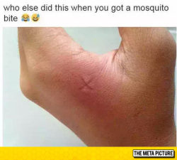 srsfunny:  Mosquito Bitehttp://srsfunny.tumblr.com/   WTH&hellip;. suddenly extra glad Im not allergic to mosquito bites&hellip;.