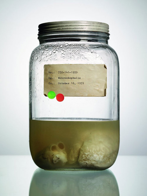 sixpenceee:  Malformed: Forgotten Brains of the Texas State Mental HospitalMalformed, from photographer Adam Voorhees and journalist Alex Hannaford, documents the strange collection of brains in jars taken from mental patients, and documents the unusual