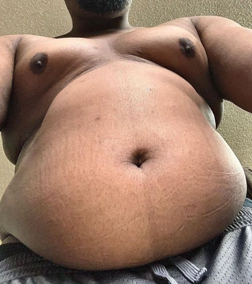 My stretch marks and belly is growingwww.instagram.com/p/CPsrPybMU83/?utm_medium=tumblr