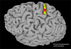 neurosciencenews: Paralyzed Patient Feels Sensation Again For the first time, scientists at Caltech have induced natural sensations in the arm of a paralyzed man by stimulating a certain region of the brain with a tiny array of electrodes. The research