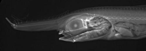staceythinx:  Images from X-ray Vision: Fish Inside Out, a traveling exhibit of x-rays of some of the creepiest creatures in the ocean taken by Sandra J. Raredon and organized by the Smithsonian’s National Museum of Natural History and the Smithsonian