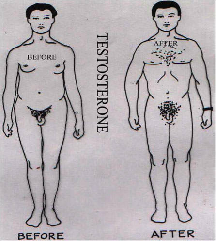 actuallyintersex:  “It would appear, from the illustration below, one can only be a ‘real man’ if one has commenced a testosterone therapy program. The ‘Before’ illustration depicts all the ‘undesirable’ characteristics associated with