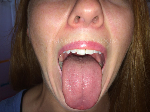 My friend Jessika showing her mouth.