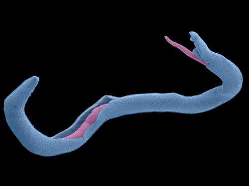 bpod-mrc: Close Contact Parasitic flatworms colonising the circulatory system, schistosomes are a se