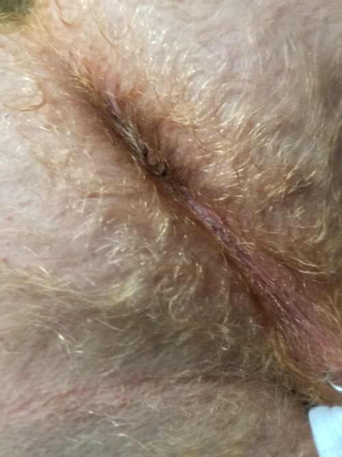 redmannuts: sharichard: jacksonl01: fuzzyballzatl: Would love to lick and eat that!!! Ginger hole&he