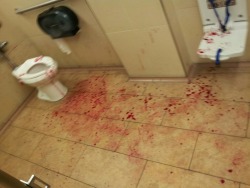 Bleed on the floor