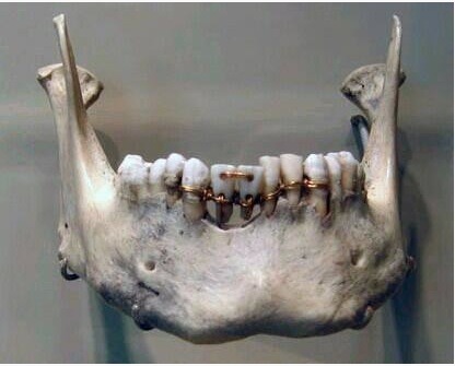 museum-of-artifacts:    Going to the dentist today is (almost) like spending the day at the spa, at least compared to dentistry thousands of years ago. While you walk into an office for a routine check-up and patiently wait to the sound of calming music