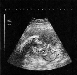 d-e-r-r-i-c-k-a:  I’m having an Alien baby.