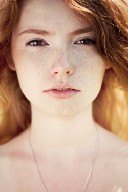 Redheads Be Here