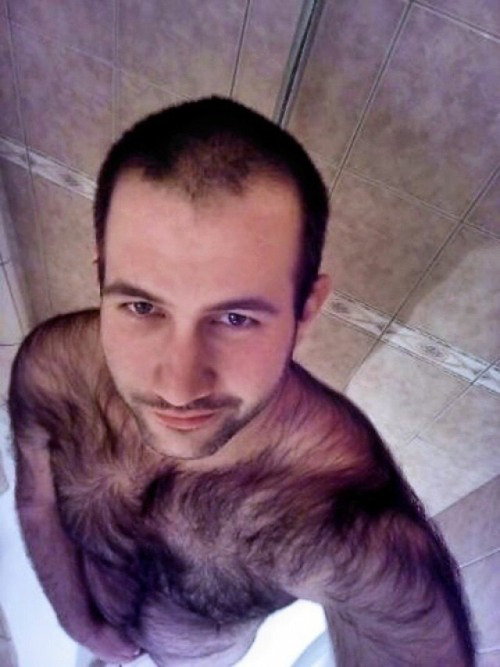 baldnhairy: