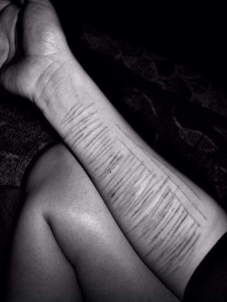 6-ianuarie:  scars on We Heart It. 