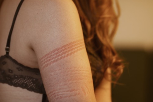 erotic-nonfiction: Rope burn Pretty rope marks by @kbnawa, photos by @chien-espagnol