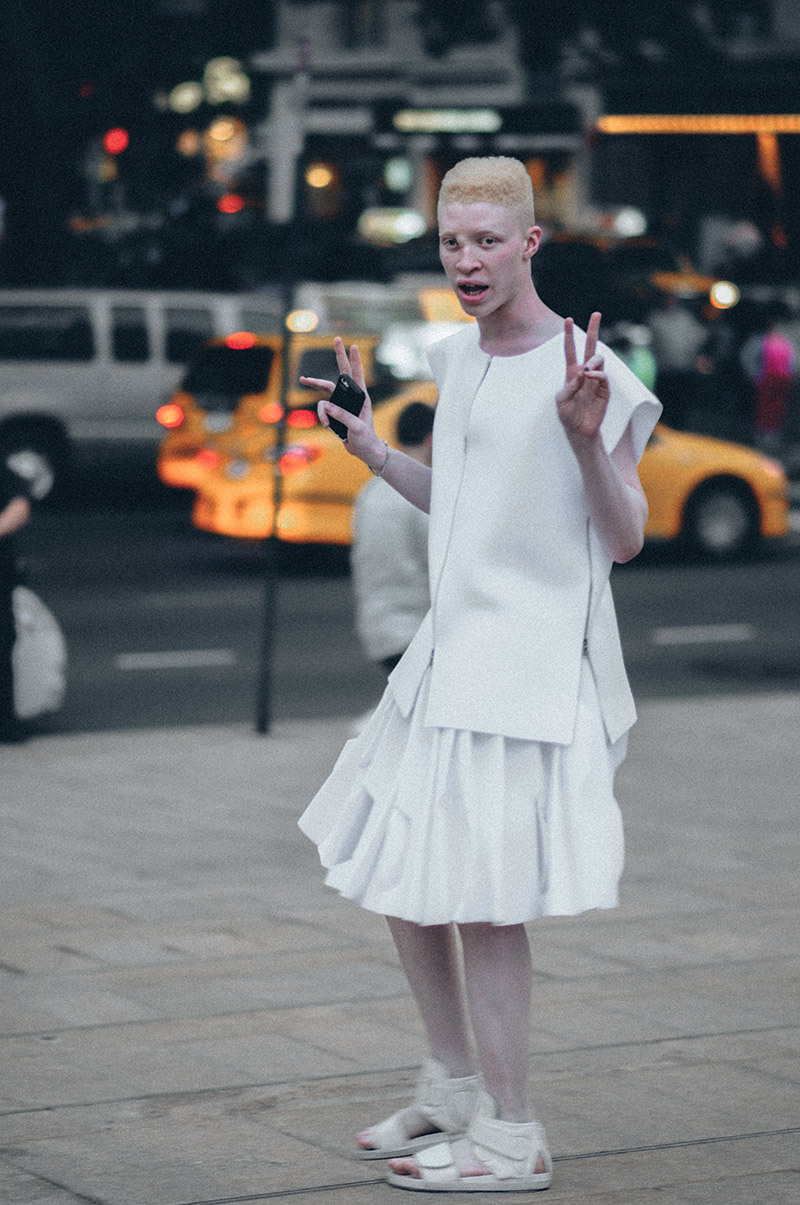 stylelikeu:  Shaun Ross is helping to redefine beauty, because is not about looking