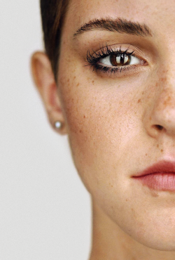 ibilateral:  freckles <3