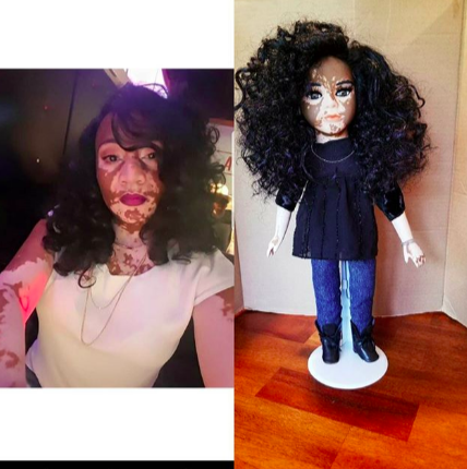 micdotcom:  An artist in Missouri is creating dolls with vitiligo and albinism to celebrate diverse beautyWhile the fashion industry is slowly opening up to models with various skin conditions — models such as Winnie Harlow, who has vitiligo, and Shaun