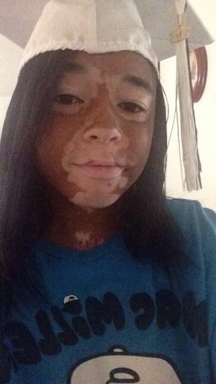 afatblackfairy:  kiirbsterr:  Look at my nose it’s cute  omfg cute cute cute