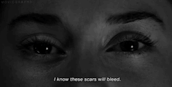 smilethroughtears96:  “I know these scars