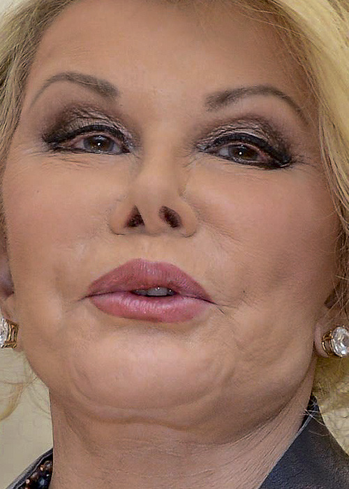 celebritycloseup:  joan rivers 