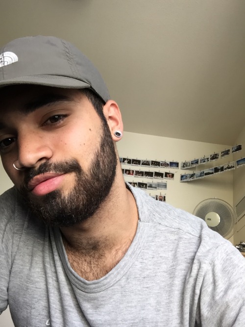 nvclearbomb:*Wears hat to hide gross hair*
