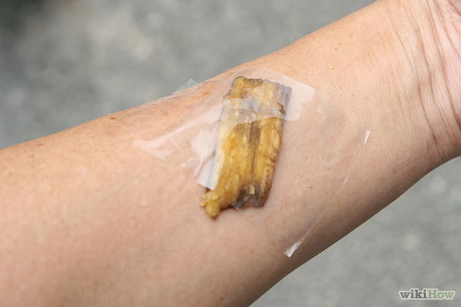 yungterra:  look man i know banana peels can supposedly aid rashes and bites and