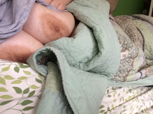 pleasantpeas:  Squish me