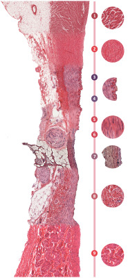 i-heart-histo:  The Seamless Blood Vessel