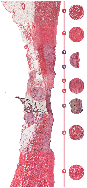 Porn photo i-heart-histo:  The Seamless Blood Vessel