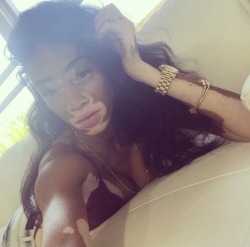 bombshellssonly:  @winnieharlow