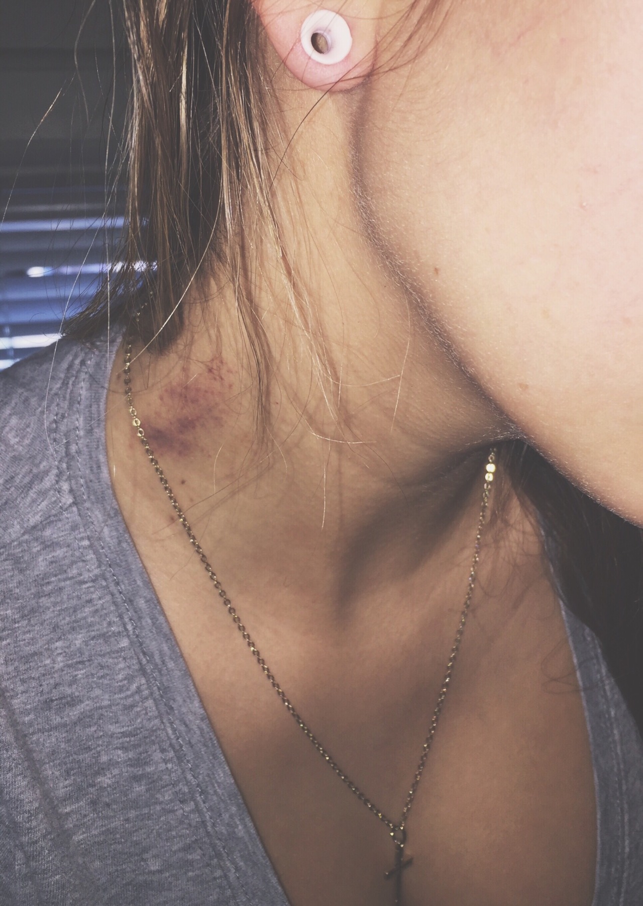 eternalizd:  are you insane like me? been in pain like me?