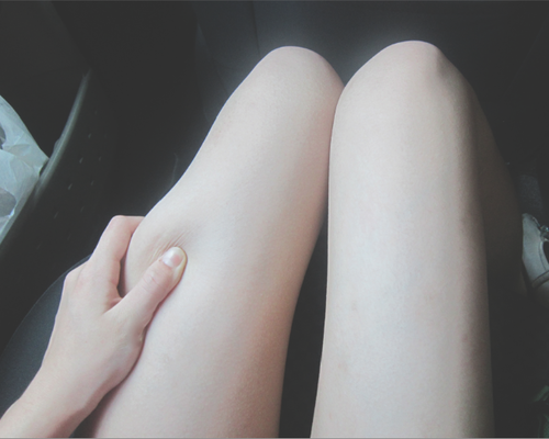 mitleidsanfall:  they’re so skinny 